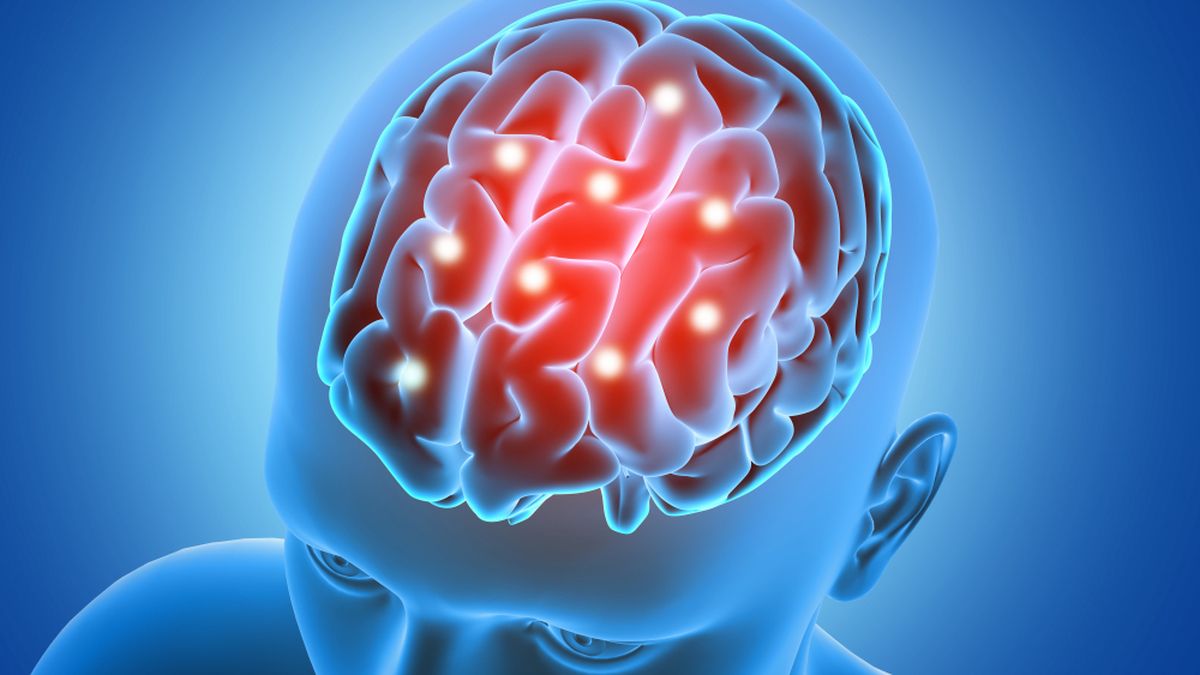 Cara Ikut Tes IQ Mensa Indonesia